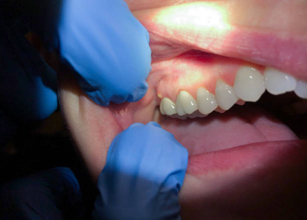 Best Emergency Orthodontic Repairs in Weatherby Lake, MO