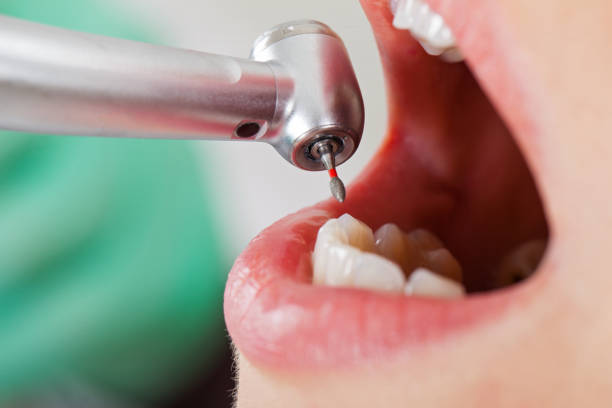 Professional Emergency Dentist in MO